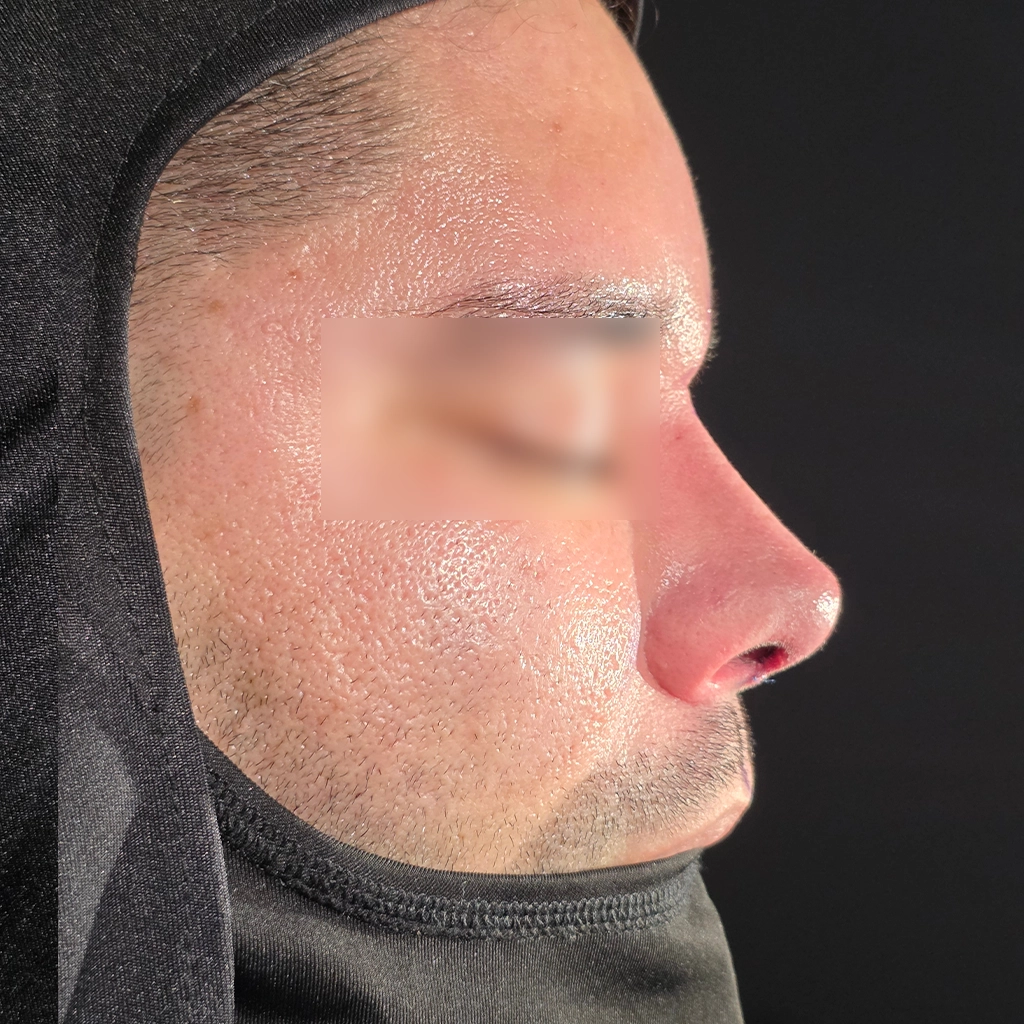 4d